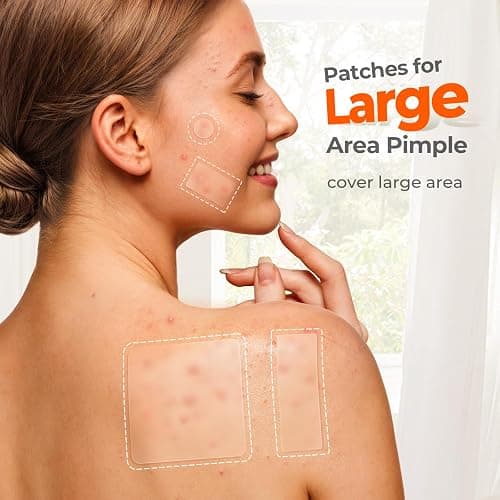 TKTK Large Pimple Patches for Face, 7 Sizes XL Acne Patches, Big Hydrocolloid Bandages for Body, Chin, Forehead, Chest, Back Zit Breakouts, Hydrocolloid Patch (Strip, Square, Dot 126 Count) thumbnail 3