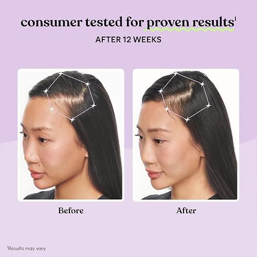 Lemme Grow Hair Growth Supplement for Women, Clinically Proven Keratin Complex for Visibly Thicker Hair and Scalp Coverage, Reduced Shedding, Nourish Thinning Hair - 1 Month Supply thumbnail 3