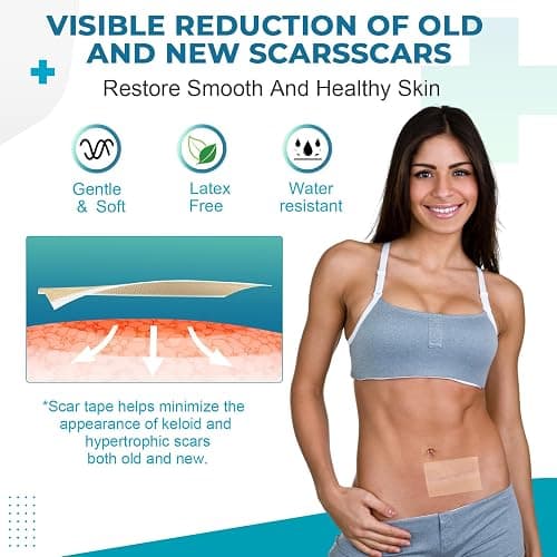 Silicone Scar Sheets, Silicone Scar Tape(1.6”x 60” Roll-1.5M), Silicone Scar Strips, Professional Scar Removal Sheets for Surgical Scars, Keloid, C-Section, Burn et thumbnail 6