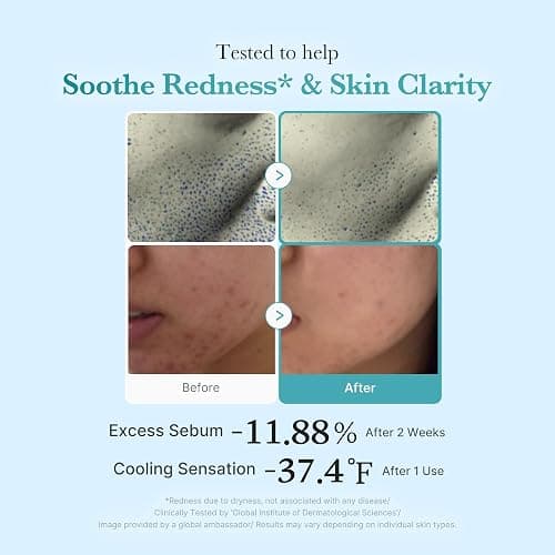 medicube Azelaic Acid Niacinamide Clarifying Toner | Troubled Skin Care, Ideal for Purifying & Calming | 4% Azelaic Acid & 2% Niacinamide| Soothing Daily Toner | Korean Skin Care | 8.45 fl.oz thumbnail 4