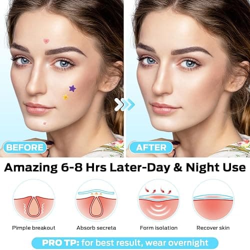VOZRO Star Pimple Patches, Colorful Hydrocolloid Acne Patches for Face, Cute Star Pimple Patches with Salicylic Acid, Tea Tree & Centella Oil (Round,Star,Peach Shapes| 6 Sizes| 271 Count) - 271 Count (Pack of 1) thumbnail 4