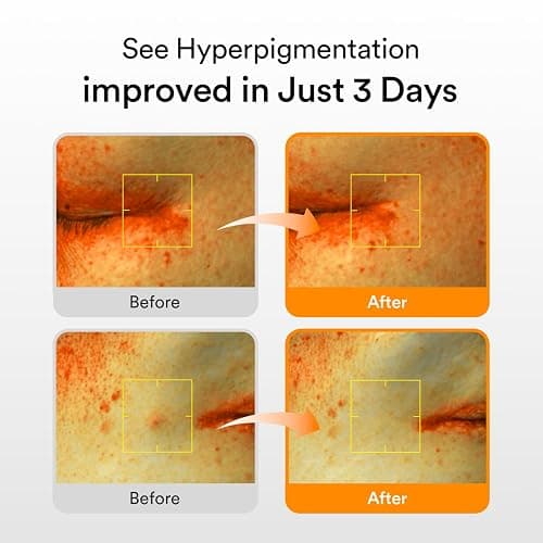 Abib Glutathiosome Dark Spot Serum Vita drop 1.69 fl.oz. | Korean Skincare, Dark Spot, Hyperpigmentation Treatment | Serum for Sensitive, Uneven Skin thumbnail 2