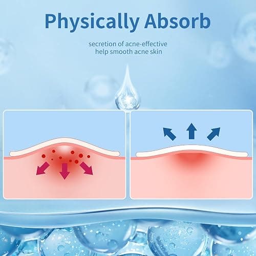 Daolyo Pimple Patches for Face, 4 Size 300 Counts Acne Patches, Hydrocolloid Patches for Covering Zits and Blemishes, Spot Stickers with Salicylic Acid, Tea Tree Oil & Calendula Oil thumbnail 6