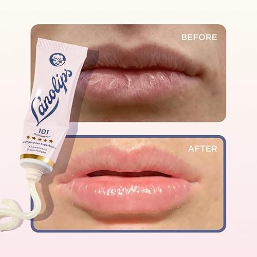 Lanolips 101 Ointment Multi-Balm Duo, Original Superbalm - Contains Pure Lanolin Oil for Smooth, Hydrated, & Healthy Lips - Natural Lip Balm for Dry Lips, Cuticles, & More (2-Pack, 0.52 oz each) thumbnail 5