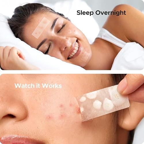 TKTK Large Pimple Patches for Face, 7 Sizes XL Acne Patches, Big Hydrocolloid Bandages for Body, Chin, Forehead, Chest, Back Zit Breakouts, Hydrocolloid Patch (Strip, Square, Dot 126 Count) thumbnail 4