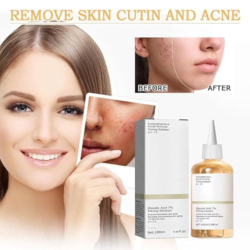 Angozo Glycolic Acid Toner,GlykolsäUre Peeling 7%-Ige -LöSung FüR Hautunreinheiten Und Akne, Toner Suitable for Combination and Oily Skin, Porenbehandlung(100ml) thumbnail 7