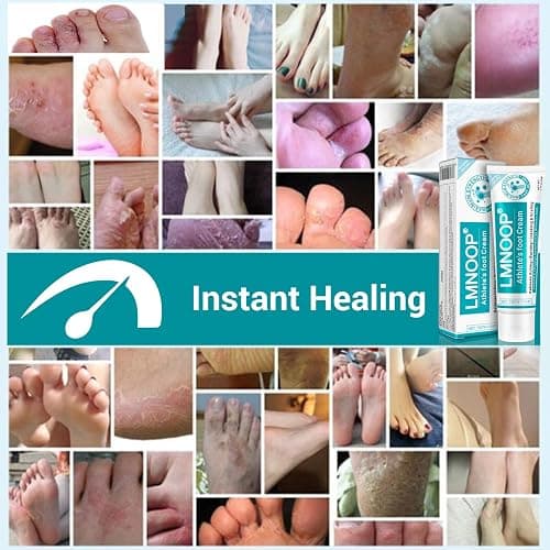 LMNOOP Athletes Foot Treatment Cream, Maximum Strength for Athlete's Foot (Tinea Pedis), Itching, Blister, Burning, Cracking, Scaling, Beriberi,Natural Herbs Antifungal Foot Cream thumbnail 7