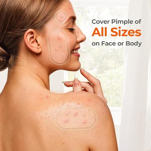 TKTK 443 Count Pimple Patches for Face, Hydrocolloid Acne Cover Patch Bulk | Pimple Stickers for Cheeks, Forehead, Chin Blemishes Zit & Breakouts, All Skin Types, Dots, Strips, Contoured 5 Sizes Variety thumbnail 8