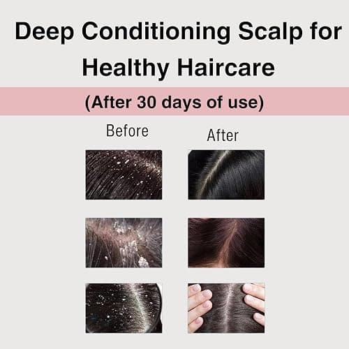 Moist Diane Keratin Shampoo and Conditioner for Women & Men, Curly Shampoo and Conditioner Set with Argan Oil, Collagen, Protein from Japan, Paraben& Sulfate Free Shampoo & Conditioner 30.4Fl Oz VITAL thumbnail 2