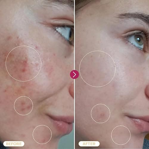 BASE LABORATORIES Hypochlorous Acid Spray for Face & Skin | 8 oz | Facial Spray Daily Skin Repair Solution for Sensitive Skin, Redness, Irritations, Eczema, Acne. Hypochlrous HOCL Molecule Spray thumbnail 7