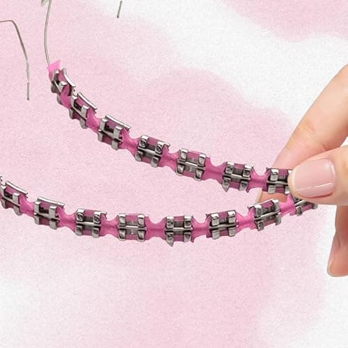 Fake Braces 2-Pcs Set Temporary Tooth Decoration with Metal Wires, Metal Brackets and Orthodontic Bands, Suitable for Orthodontists to Explain, for Dental Students to Practice (Pink) thumbnail 5