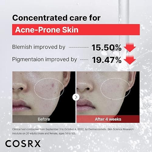 COSRX 15% Niacinamide Face Serum, 0.67 fl oz, Pore Minimizer Serum for Face, Even Skin Tone, Korean Skin Care thumbnail 4