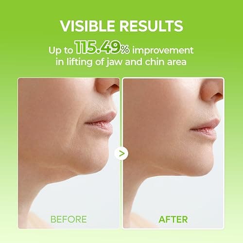 Dr.Melaxin CACTOX V-LIFTING MEWING BAND with Cactus Cooling Reduce Puffiness & Pore Tightening for Visible Pore Care Skin Repair thumbnail 5