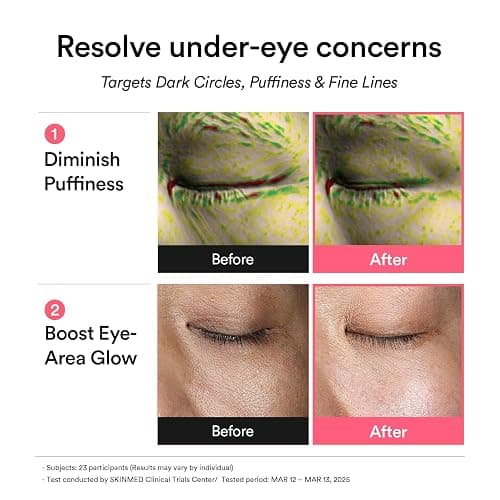 Abib PDRN Retinal Eye Patch, Hydrogel Masks for Dark Circles, Puffiness, Fine Lines, 60 Patches, 84g, with Niacinamide, K-Beauty Skincare thumbnail 4