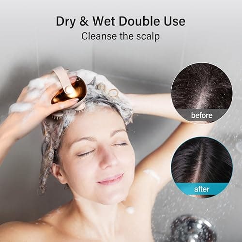 arboleaf Electric Scalp Massager Head Massager Scalp Stress Relax, 5 in 1 Kneading 128 Massage Nodes, Waterproof Hair Massage with 8 Removable Claws Cat Scratcher, Gift for Dad Mom thumbnail 4