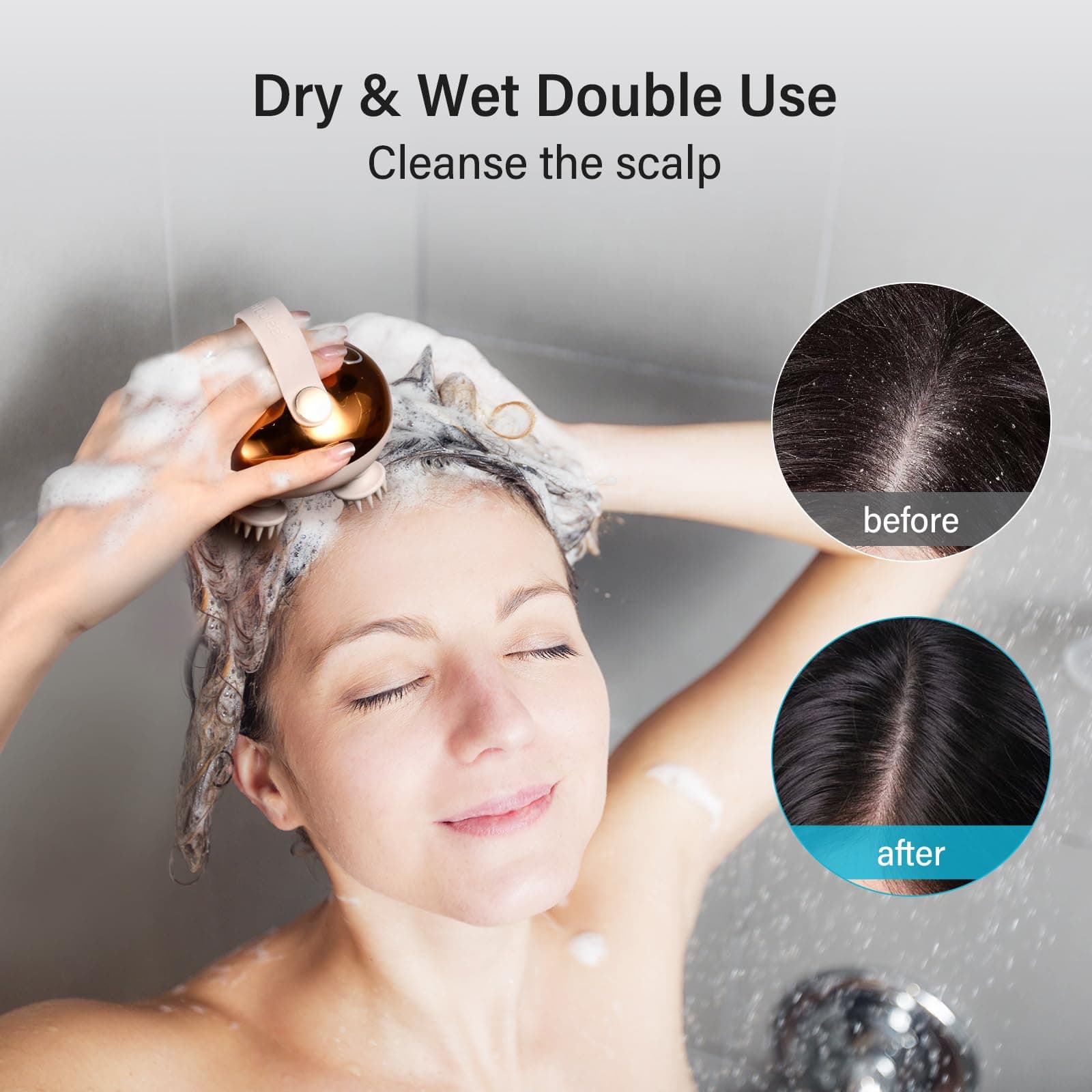 Arboleaf Electric Scalp Massager for Hair Growth - Portable Rechargeable Head Massager, Waterproof Handheld Hair Scratcher With 8 Removable Massage Claws, Stress Relief, Gold thumbnail 4