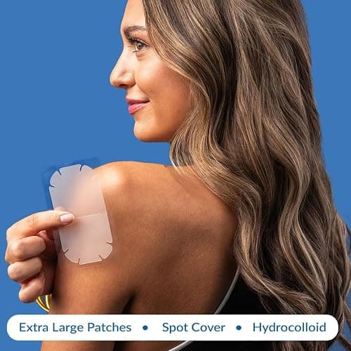 EZACNE™ Extra Large Pimple Patches for Body – Large Hydrocolloid Acne Patches for Back, Face, Forehead, Chin, Neck, Shoulders – Big Zit Patch for Breakouts (5 Count) thumbnail 6
