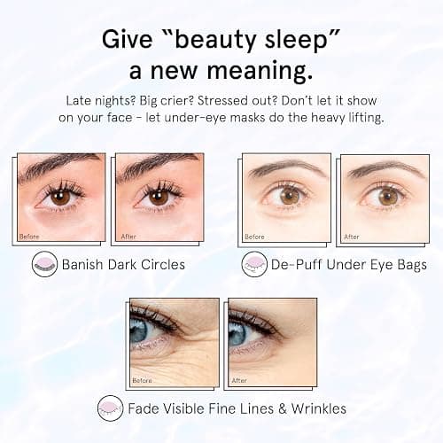 grace & stella Retinol Under Eye Patches for Puffy Eyes & Dark Circles - Restoring Gel Under Eye Masks with Hyaluronic Acid - Bridesmaid Gifts, Birthday Gifts for Women (Purple, 24 Pairs) thumbnail 4