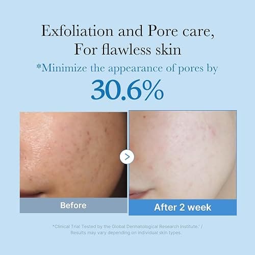 medicube Zero Pore Toner I Exfoliating & Hydrating Blue Bottle Water Toner with AHA, BHA, PHA, Niacinamide, and Panthenol | Korean Skin Care for Pores, Texture, and Moisture Care (8.45 fl. oz.) thumbnail 2
