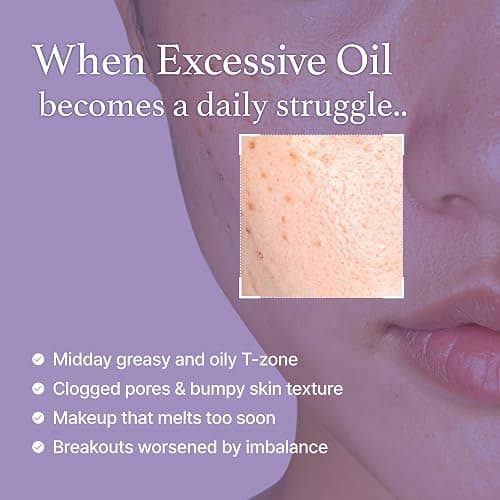 I'm from Black Rice Toner for Oily Skin, Sebum Control Toner, Lightweight, Niacinamide, Panthenol, Fragrance Free, Korean Skin Care, 150ml, 5.07 fl.oz thumbnail 3