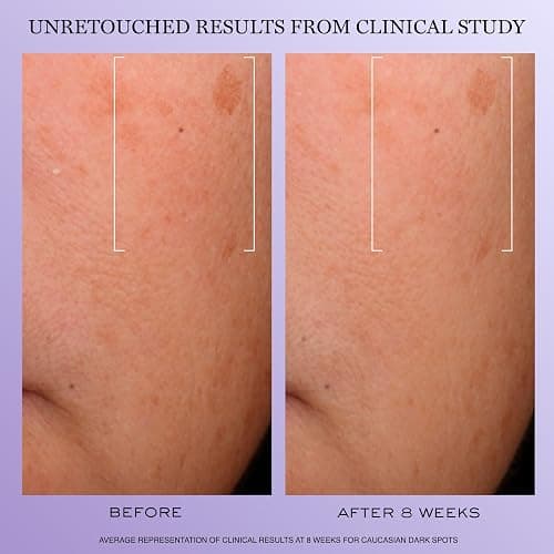 Lancôme Rénergie H.C.F. Triple Serum - Hyaluronic Acid Serum for Visible Correction of Anti Aging Signs & Dark Spots - With Vitamin C+, Niacinamide & Ferulic Acid thumbnail 4
