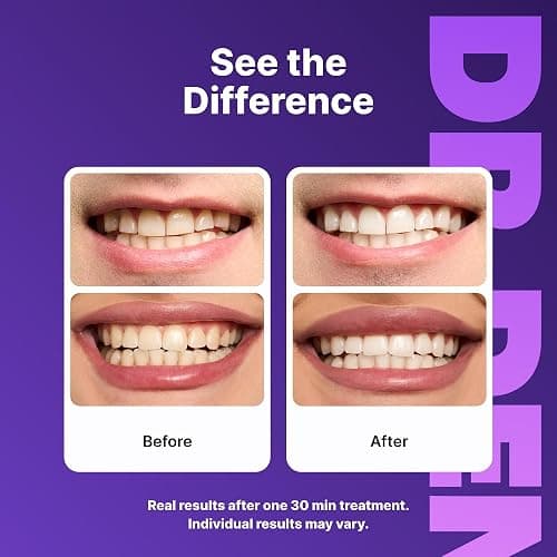 DRDENT Purple Teeth Whitening Strips 21 Treatments - Safe for Enamel - Non Sensitive Teeth Whitening - Whitening Without Any Harm - Pack of 42 Strips thumbnail 2