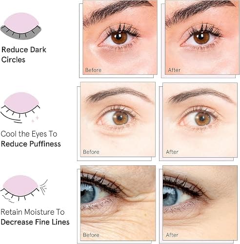 grace & stella Award Winning Under Eye Gel Patches - Reduce Dark Circles, Puffy Eyes, Undereye Bags, Wrinkles - Travel Essentials & Toiletries, Vegan Cruelty-Free Self Care (4 Pairs, Gold) thumbnail 3