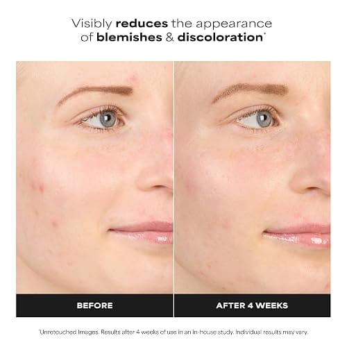 Paula's Choice BOOST 10% Azelaic Acid Booster Cream Gel Face Serum with Salicylic Acid, Minimizes Look of Redness & Fades Discoloration, Oil-Free Skin Brightening Serum for Face, Fragrance-Free thumbnail 3