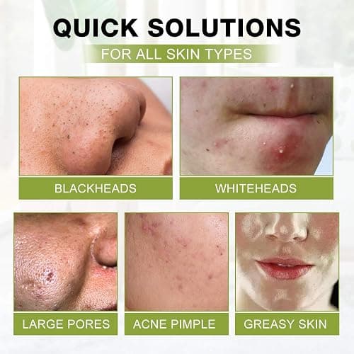 Blackhead Peel Off Face Mask, SHVYOG 3-in-1 Blackhead Remover Charcoal Mask with Brush & Tea Tree Serum, Purifying Deep Cleansing Black Mask for Blackheads, Dirt, Acne, Pores Shrinking (100g+30ml) thumbnail 5