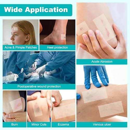 Hydrocolloid Roll for Wound Care, Hydrocolloid Bandages with Self-Adhesive, Cut-to-Size Patch Bandages, Ultra Absorbent, Waterproof, First Aid Kit Essential (2IN*4.8FT) thumbnail 5