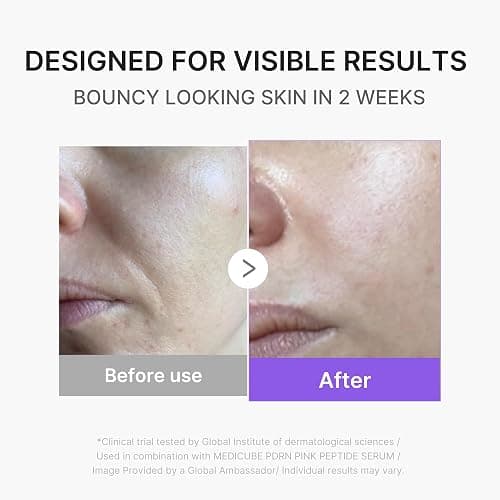 medicube Mini Booster Pro Plus | Facial Device for Radiant, Calming, and Bouncy-Looking Skin | Red, Blue, Purple 3-Mode | Portable Korean Skincare Device, At Home Care | Pink thumbnail 4