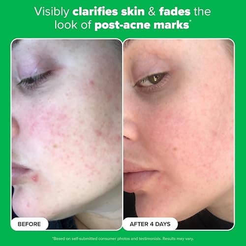 Paula's Choice BOOST 10% Azelaic Acid Booster Cream Gel Face Serum with Salicylic Acid, Oil-Free Skin Brightening Serum for Face, Fragrance-Free - 1 Ounce (Pack of 1) thumbnail 5