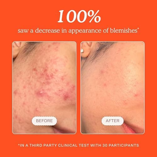 Tower 28 SOS Daily Rescue Facial Spray - Hypochlorous Acid Spray to Help Reduce Redness, Calm Irritation + Alleviate Flare-Ups - Purifying Travel Size Face Toner - Everyday Skin Care Essential (1 oz) thumbnail 4