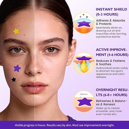 DATISEP Pimple Patches for Face, 560 Counts Star Acne Patches, 7 Colors Cute Spot Stickers for Zits, Hydrocolloid Breakouts with Salicylic Acid, Tea Tree Oil & Calendula Oil (8mm, 10mm, 12mm & 14mm) thumbnail 6