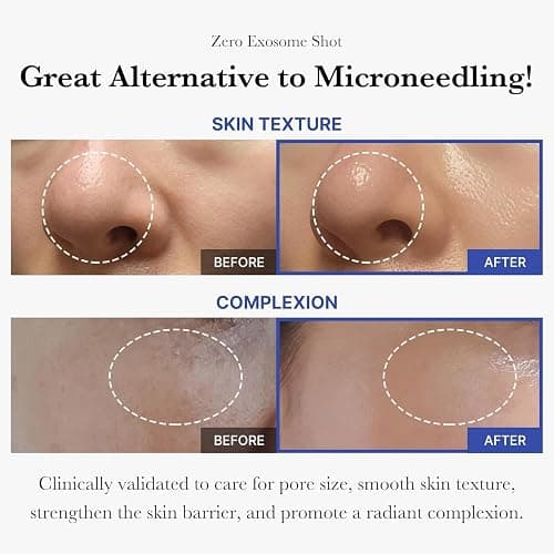 medicube Zero Exosome Shot 2,000 PPM Spicule Facial Serum | Liquid Skin Booster Serum | Exosome, AHA+BHA+PHA | Pore Care, Dead Skin Cells, Skin Texture | Korean Skin Care 1.01 fl.oz thumbnail 3