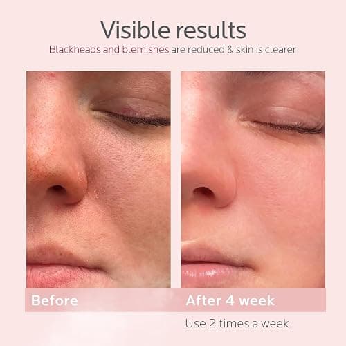 Colorfarm Facial Steamer Skin Care Kit: Face Steamer Home Spa Deep Cleaning Unclogs Pores Blackheads with 4 Skin Care Tools - Relaxing Self Care Gifts for Women (Gentle Exfoliation & Cleansing Kit) thumbnail 6