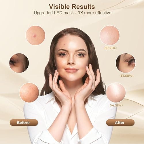 Red Light Therapy for Face, Led Face Mask Light Therapy with Rechargeable Remote, LED Face Mask Light Therapy at Home, Comfortable Red Light Therapy Mask thumbnail 3