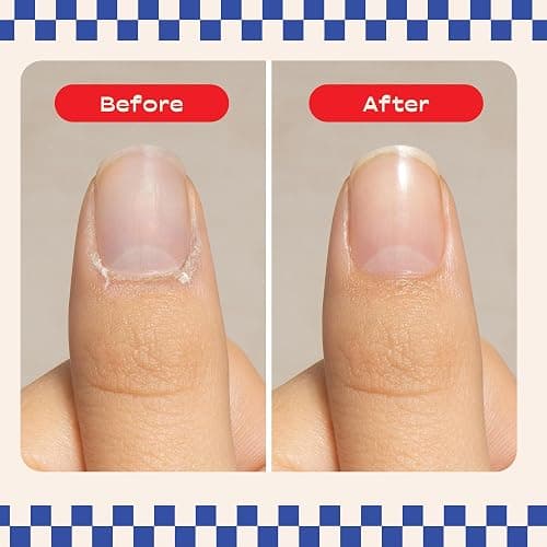 Cuticle & Co Cotton Candy Scented Cuticle Oil 1 oz - Professional Nail Manicure & Pedicure Care for Dry Cuticles - Hydrating Nail Treatment for Nails & Skin - Cotton Candy Scent thumbnail 7