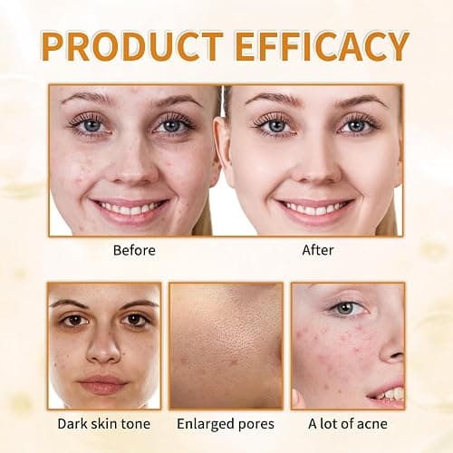 7% Glycolic Acid Exfoliating Toner, Exfoliating Facial Toner, Pore Minimizing Toner, Smooth Skin, Even Tone, Hydrating Formula thumbnail 7