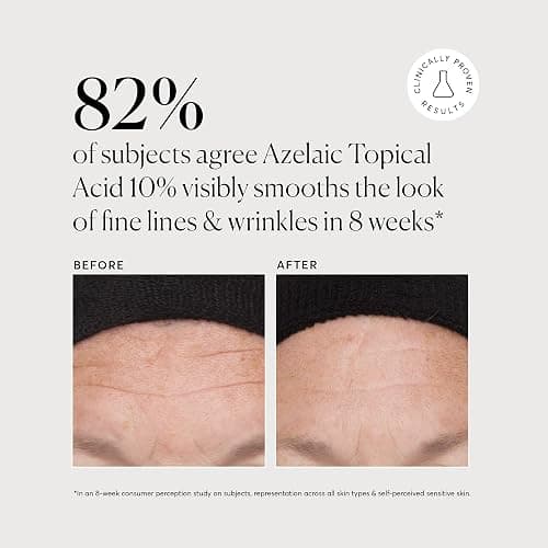 Azelaic Topical Acid 10% from Naturium - Face & Skin Care Beauty Treatment with Niacinamide & Vitamin C, 1 oz thumbnail 4