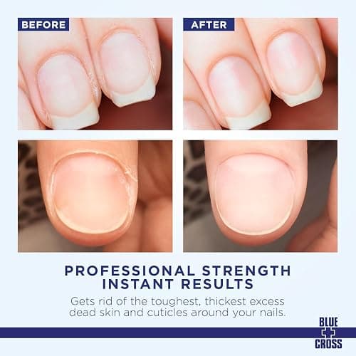 Cuticle Remover & Softener Liquid for Nails – Blue Cross Professional Nail Care with Lanolin, Hydrating Treatment for Dry Cuticles & Hangnails, Made in USA, 6oz thumbnail 2