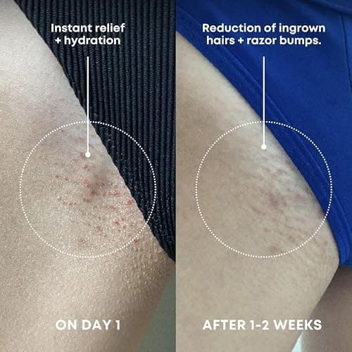 Bushbalm Ingrown Hair Exfoliating Scrub - Reduces Appearance of Ingrown Hairs and Razor Bumps, Soothes Skin and Post-Shave Redness - Nude, 236 ml thumbnail 3
