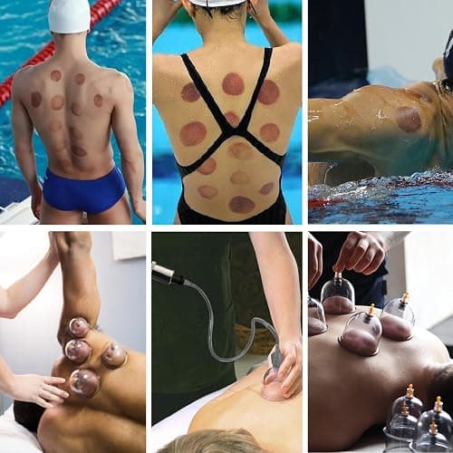 DEFUNX Cupping Therapy Set, 19 Cups Cupping Kit for Massage Therapy, Cupping Set with Pump for Back Massage, Pain Relief, Physical Therapy thumbnail 7