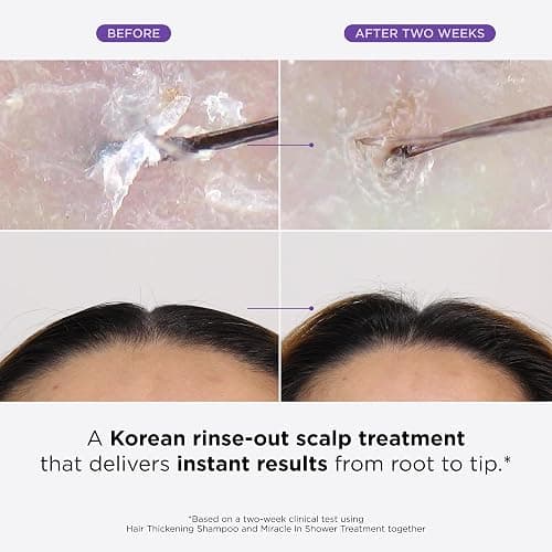 Dr. Groot Miracle in Shower Treatment, Korean Hair Care, 5 Seconds to Smooth Hair, Rosemary Oil for Healthier-Looking Hair, Hair Rinse, Moisturizing Hair Treatment, Kbeauty Scalp Revitalizing Solution thumbnail 2