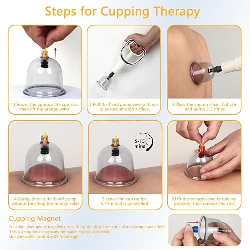 Cupping Kit - 12 cups thumbnail 6