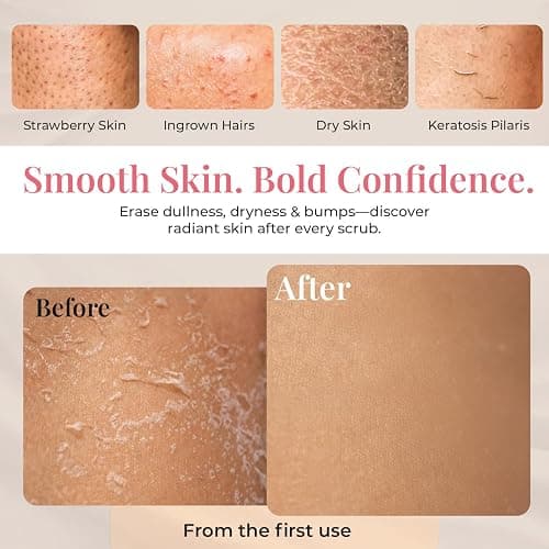 Kessa Exfoliating Glove for Shower, Made with 100% Natural Viscose - 2pcs | Korean Exfoliating Mitt Helps to Remove Dead Skin, Improve Skin Tone & Ideal for Keratosis Pilaris & Self Tanning thumbnail 5