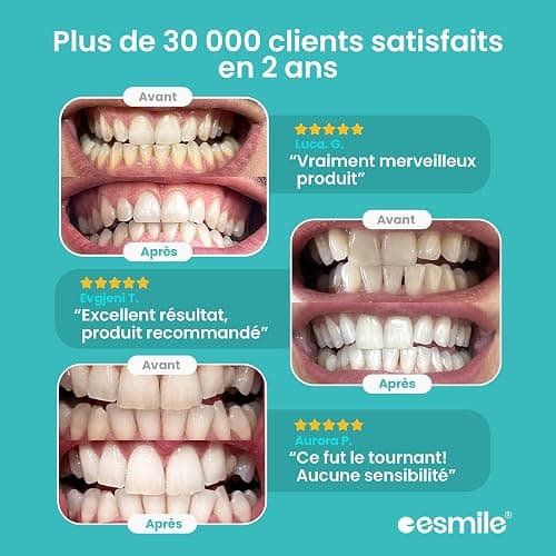 EASY SMILE - Kit de Blanchiment Dentaire Professionnel avec Lampe LED 16X - 3 Gels pour un Blanchiment Rapide et Efficace, Élimine les Taches Profondes (Kit de blanchiment) thumbnail 3