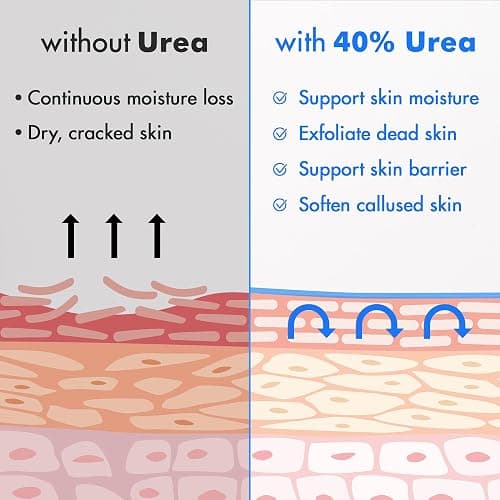Ebanel Urea Cream 40% plus Salicylic Acid 2% for Dry Cracked Feet Skin | Deeply Moisturizes & Softens Dry Cracked Heels, Feet, Knees, Elbows, Hands, Rough Dead Skin Callus Remover Toenail Softener thumbnail 5