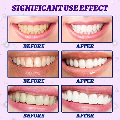 Purple Teeth Whitening Strips - V34 Whitening Strips - Enamel Safe Whitener Strips for Sensitive Teeth - Gentle Stain Removal for Sensitive Tooth,30 Minutes Fast Results,7pcs thumbnail 5