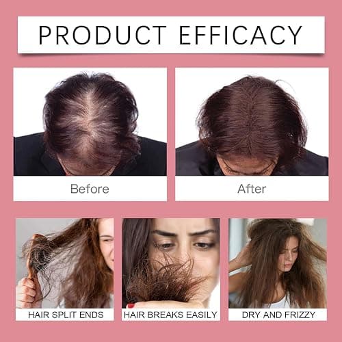 Advanced Hair Regrowth Serum for Scalp 50ml, Hair Growth Oil Spray Promotes Hair Growth and Strengthening - Non-Greasy, Hormone-Free, Fast-Absorbing Formula – Fights Hair Thinning & Hair Loss thumbnail 3
